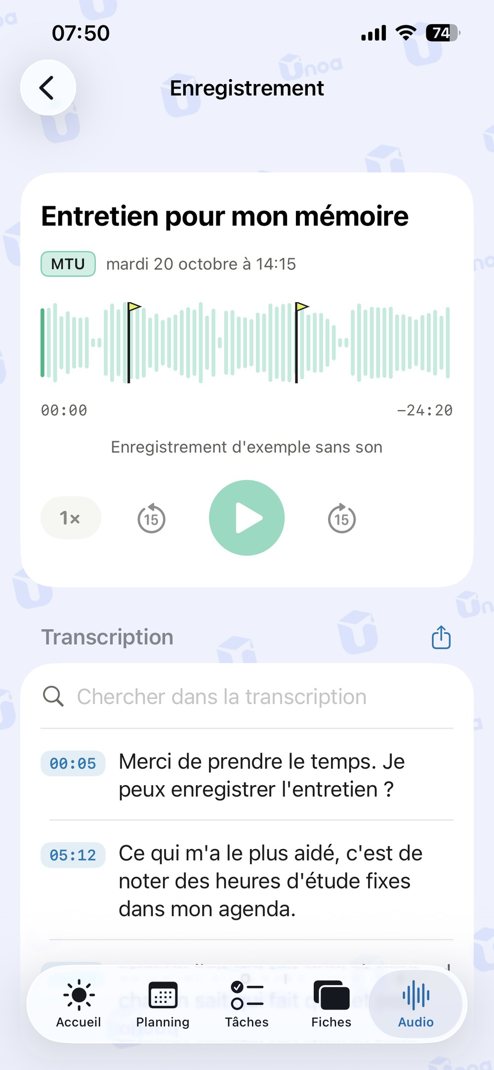 Enregistrement avec trois repères d'examen sur l'onde